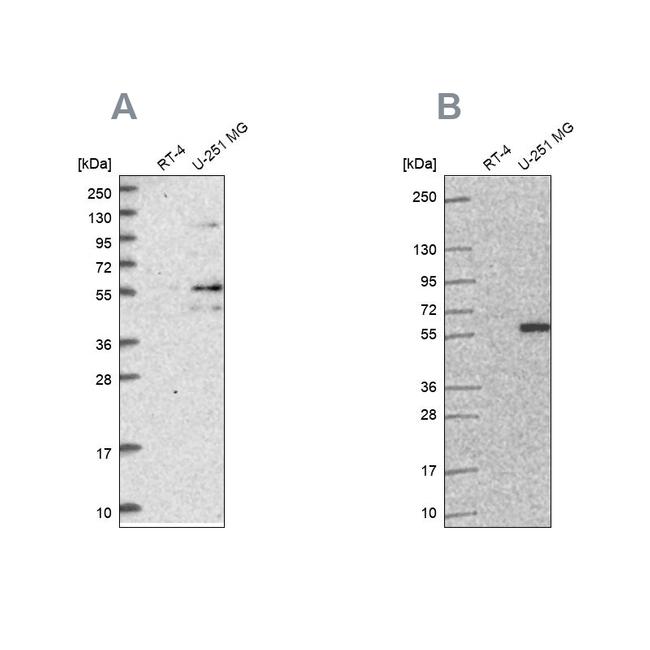 ACSBG1 Antibody in Western Blot (WB)