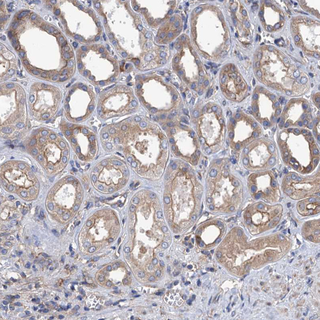 KCC4 Antibody in Immunohistochemistry (IHC)