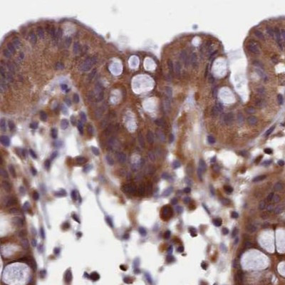 NUBP1 Antibody in Immunohistochemistry (IHC)