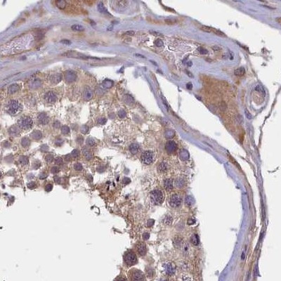 NUBP1 Antibody in Immunohistochemistry (IHC)