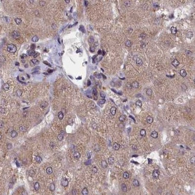 NUBP1 Antibody in Immunohistochemistry (IHC)