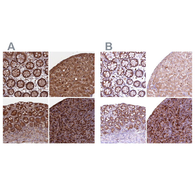 Flavin reductase Antibody in Immunohistochemistry (IHC)