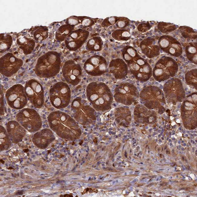 Flavin reductase Antibody in Immunohistochemistry (IHC)