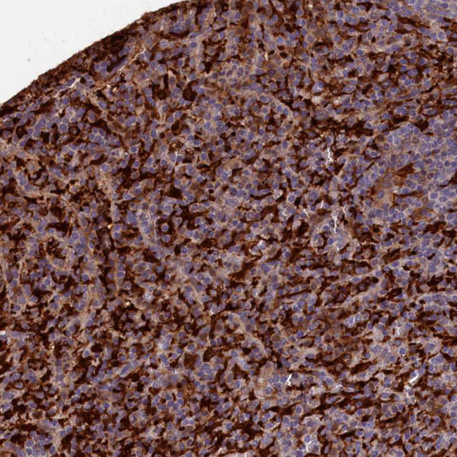 Flavin reductase Antibody in Immunohistochemistry (IHC)