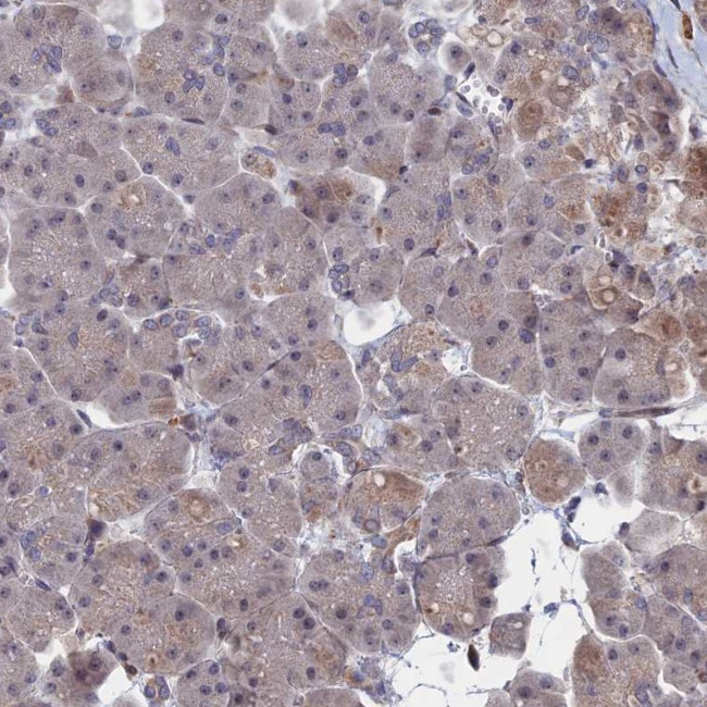 LYPLA3 Antibody in Immunohistochemistry (IHC)