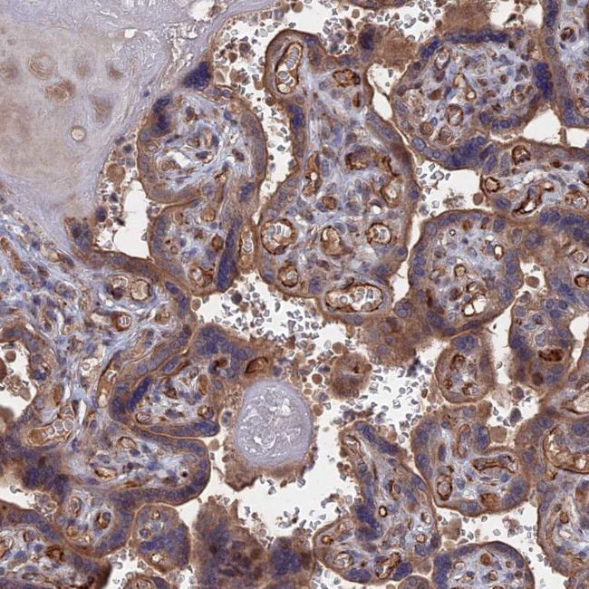 LYPLA3 Antibody in Immunohistochemistry (IHC)