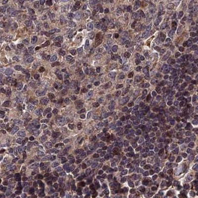 LYPLA3 Antibody in Immunohistochemistry (IHC)