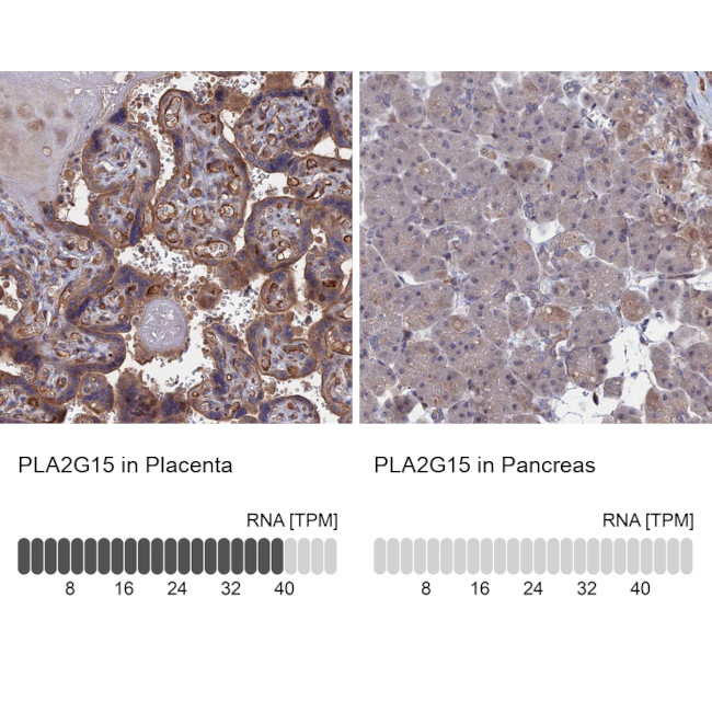 LYPLA3 Antibody