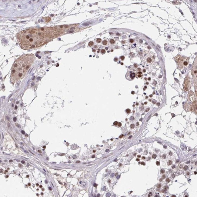 RBBP6 Antibody in Immunohistochemistry (IHC)