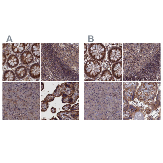 LYPLA3 Antibody in Immunohistochemistry (IHC)