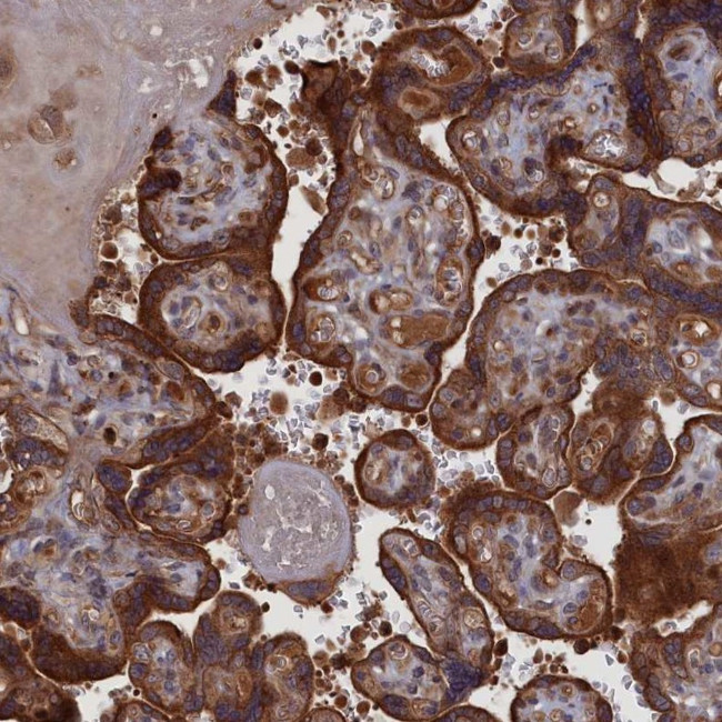 LYPLA3 Antibody in Immunohistochemistry (IHC)