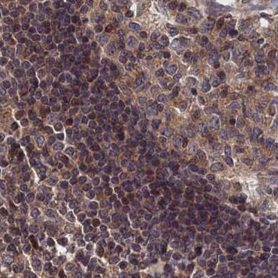 LYPLA3 Antibody in Immunohistochemistry (IHC)