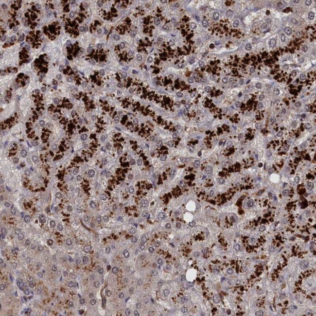 LYPLA3 Antibody in Immunohistochemistry (IHC)