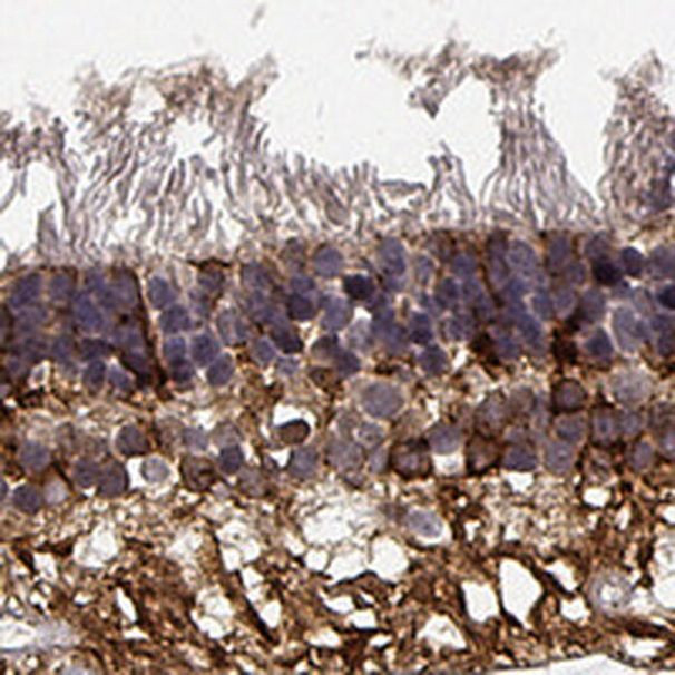 NPVF Antibody in Immunohistochemistry (IHC)