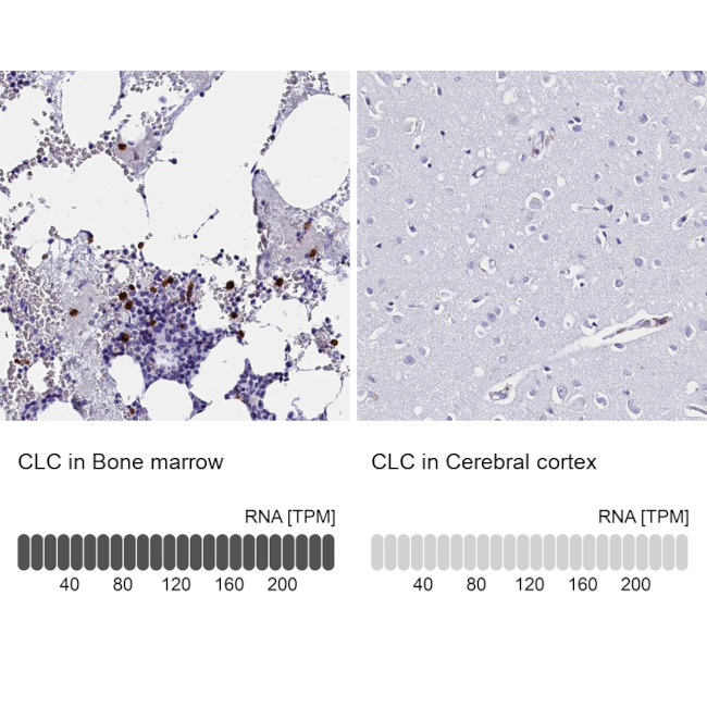 Galectin 10 Antibody in Immunohistochemistry (IHC)