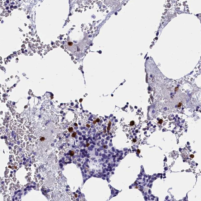 Galectin 10 Antibody in Immunohistochemistry (IHC)