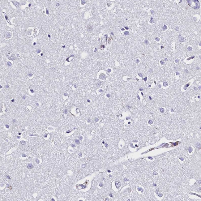 Galectin 10 Antibody in Immunohistochemistry (IHC)