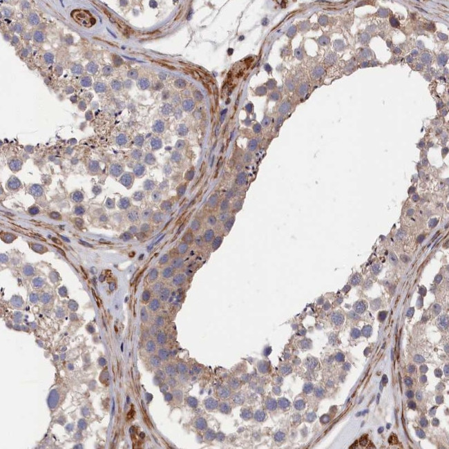 LDHD Antibody in Immunohistochemistry (IHC)