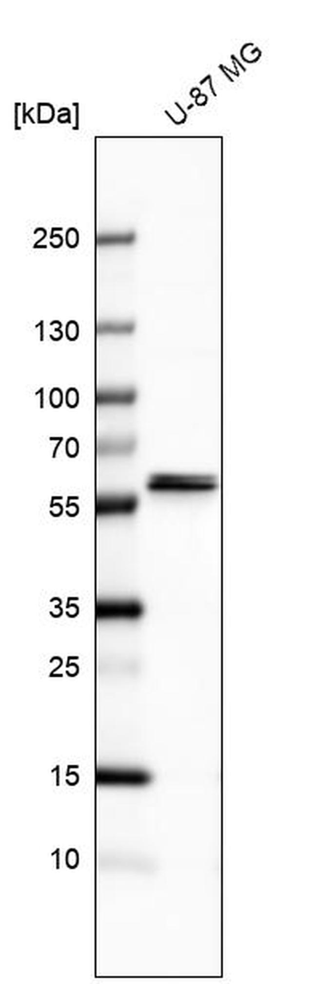 CARS2 Antibody in Western Blot (WB)