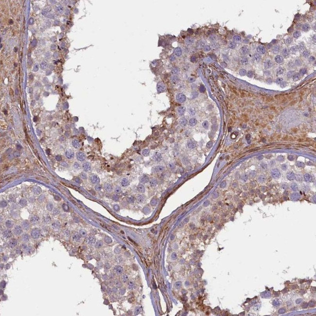 FUZ Antibody in Immunohistochemistry (IHC)