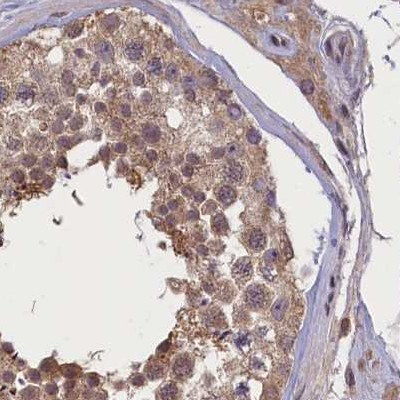 NUBP1 Antibody in Immunohistochemistry (IHC)