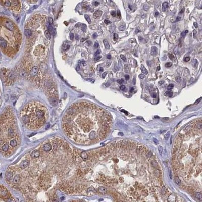 NUBP1 Antibody in Immunohistochemistry (IHC)