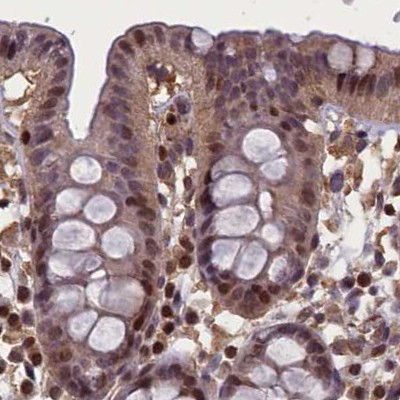 NUBP1 Antibody in Immunohistochemistry (IHC)