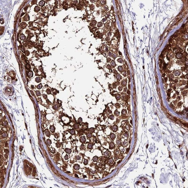 LSM7 Antibody in Immunohistochemistry (IHC)