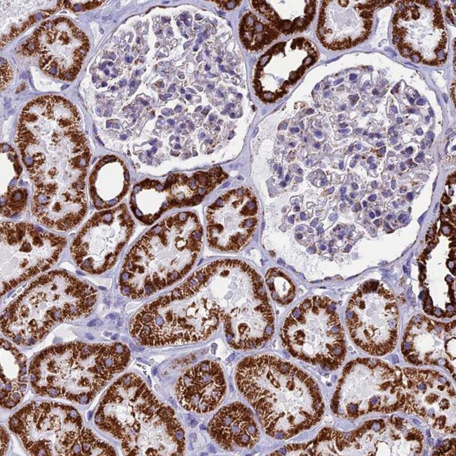 UQCRFS1 Antibody in Immunohistochemistry (IHC)