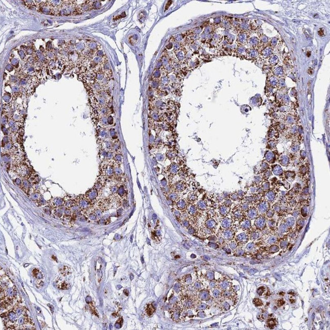 UQCRFS1 Antibody in Immunohistochemistry (IHC)