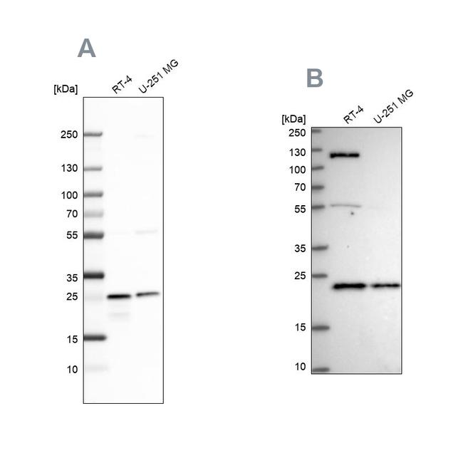 UQCRFS1 Antibody in Western Blot (WB)