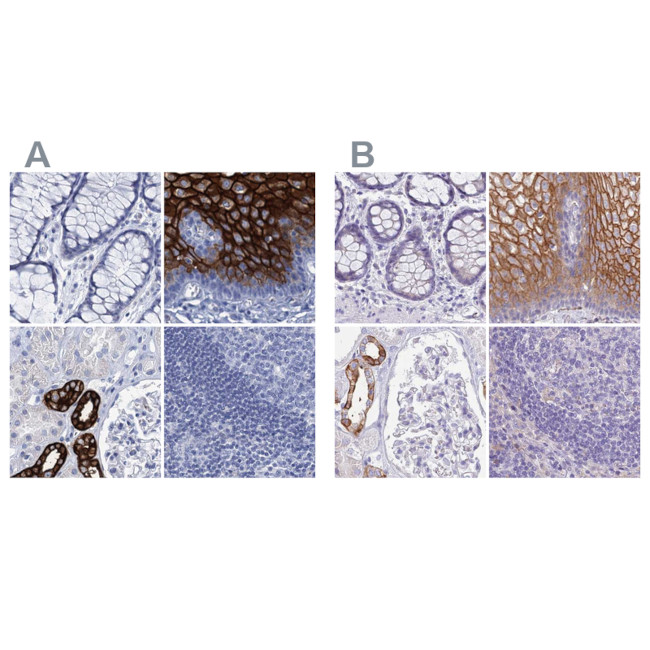 RHCG Antibody in Immunohistochemistry (IHC)