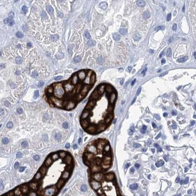 RHCG Antibody in Immunohistochemistry (IHC)