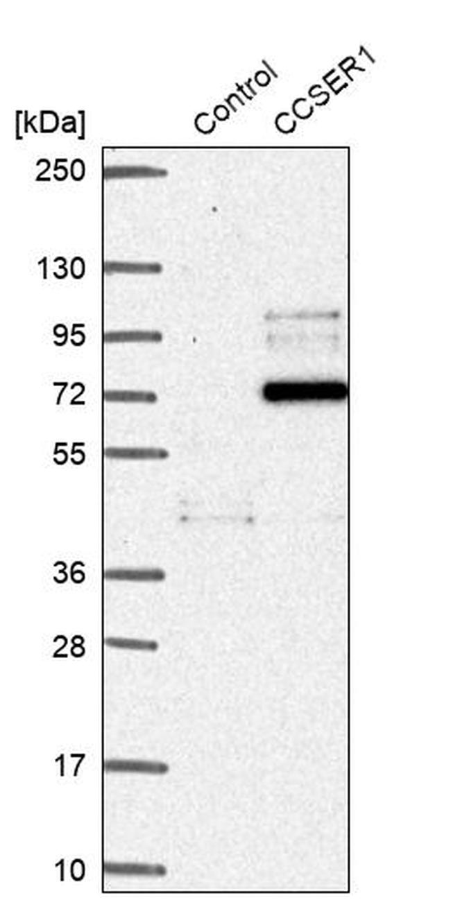 KIAA1680 Antibody in Western Blot (WB)