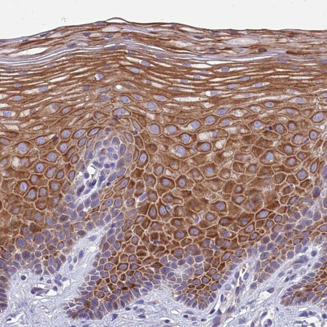 MVB12A Antibody in Immunohistochemistry (IHC)