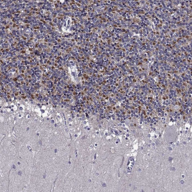 C15orf27 Antibody in Immunohistochemistry (IHC)