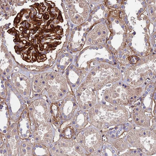 EVA1B Antibody in Immunohistochemistry (IHC)