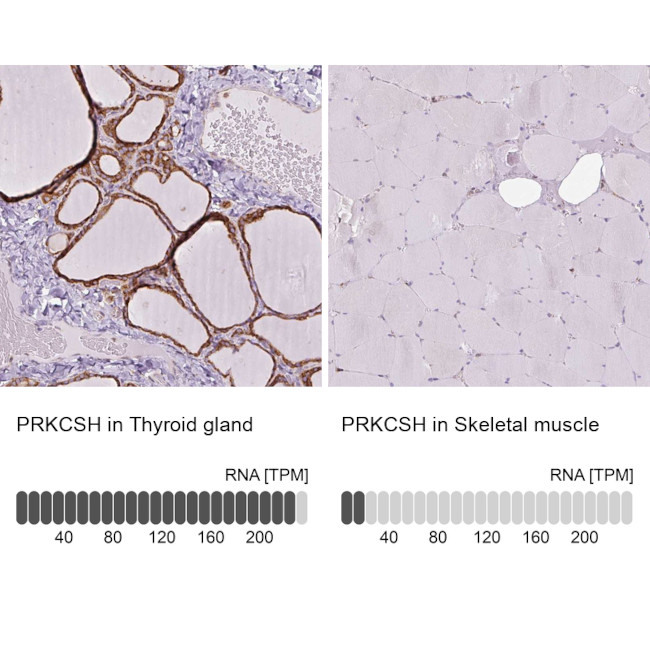 PRKCSH Antibody in Immunohistochemistry (IHC)