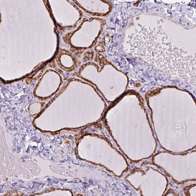 PRKCSH Antibody in Immunohistochemistry (IHC)