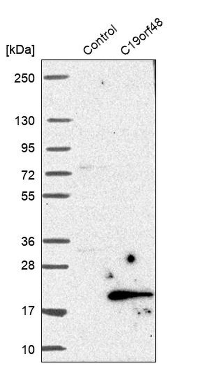 C19orf48 Antibody in Western Blot (WB)