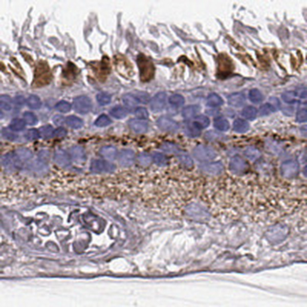 RDH13 Antibody in Immunohistochemistry (IHC)