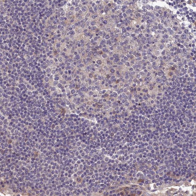 BRUNOL5 Antibody in Immunohistochemistry (IHC)