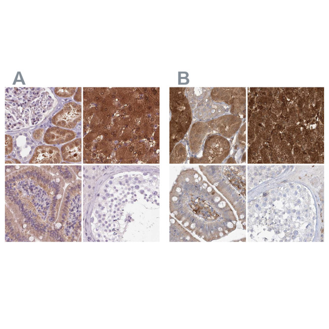 HAAO Antibody in Immunohistochemistry (IHC)