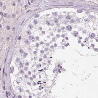 HAAO Antibody in Immunohistochemistry (IHC)