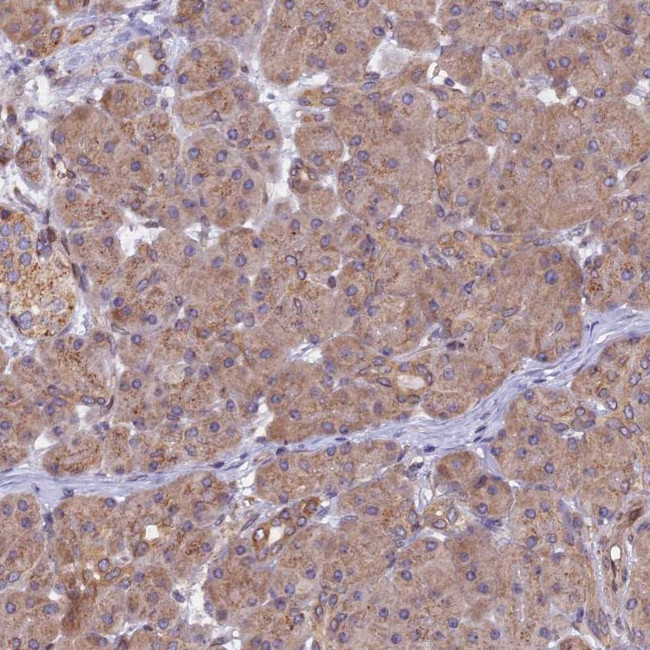 CHMP2A Antibody in Immunohistochemistry (IHC)