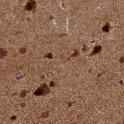 NAE1 Antibody in Immunohistochemistry (IHC)