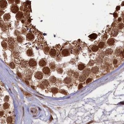 NAE1 Antibody in Immunohistochemistry (IHC)