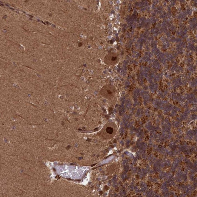 NAE1 Antibody in Immunohistochemistry (IHC)