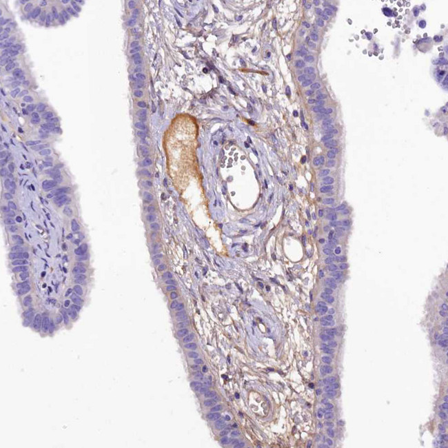 SOD3 Antibody in Immunohistochemistry (IHC)