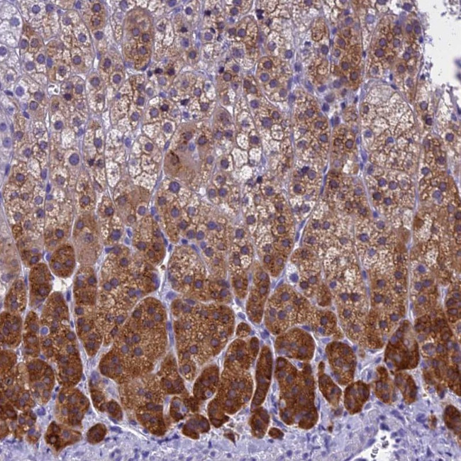 KCTD14 Antibody in Immunohistochemistry (IHC)